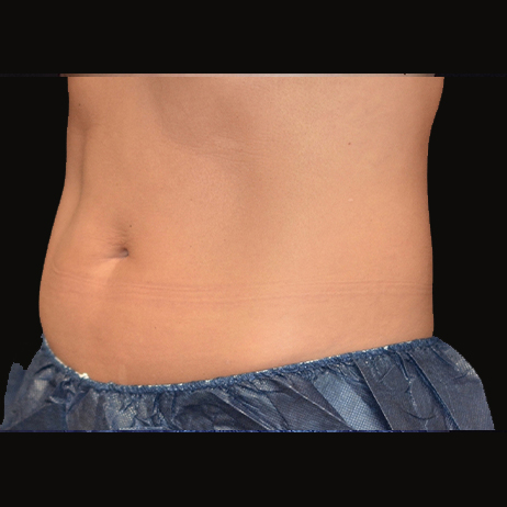 Client 4 - AFTER Weight Loss and Diet 2 Client 4 - AFTER Weight Loss and Diet 2