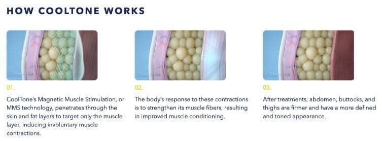 CoolTone For Weight Loss CoolTone For Weight Loss