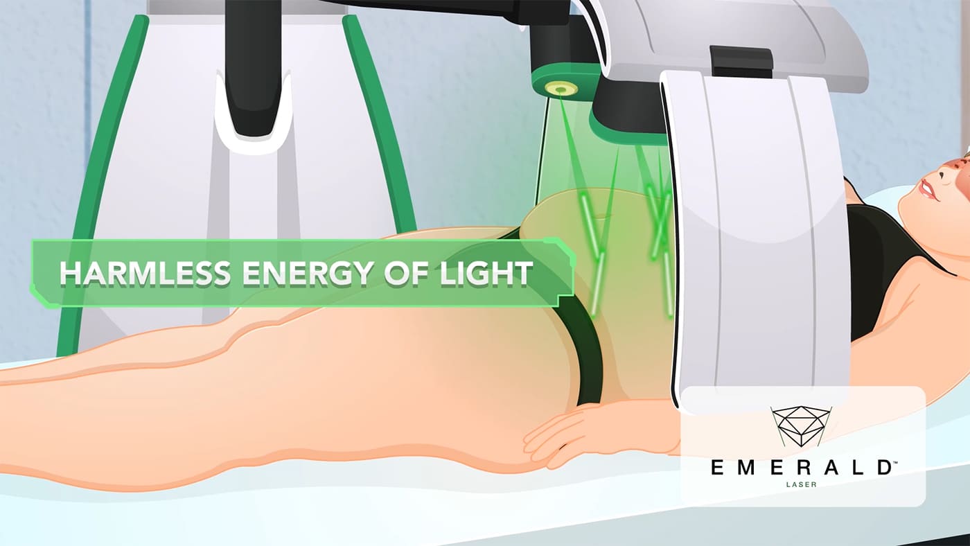 Emerald Weight Loss Laser Emerald Weight Loss Laser