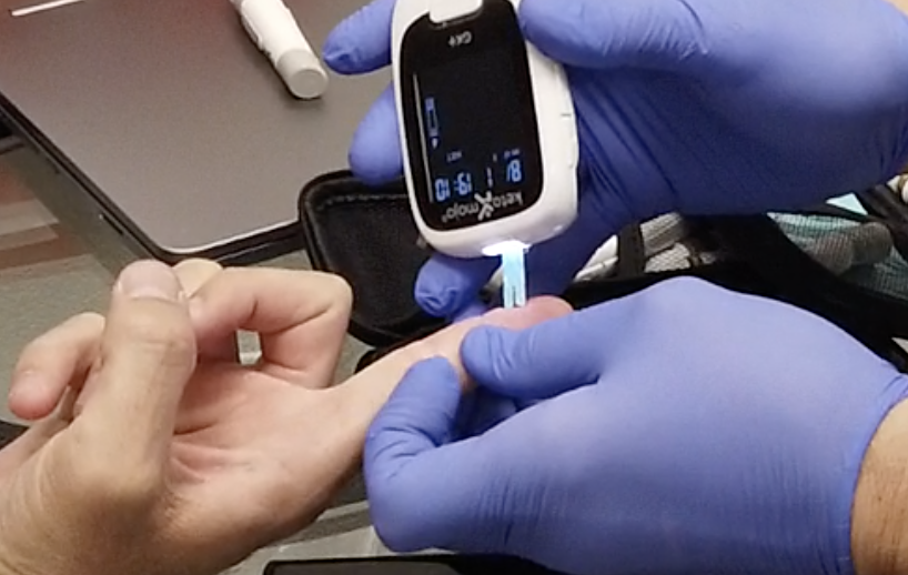 weight loss blood test super closeup weight loss blood test super closeup