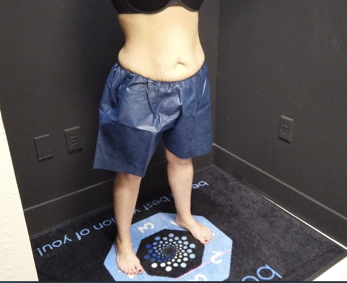 weight loss photos weight loss photos
